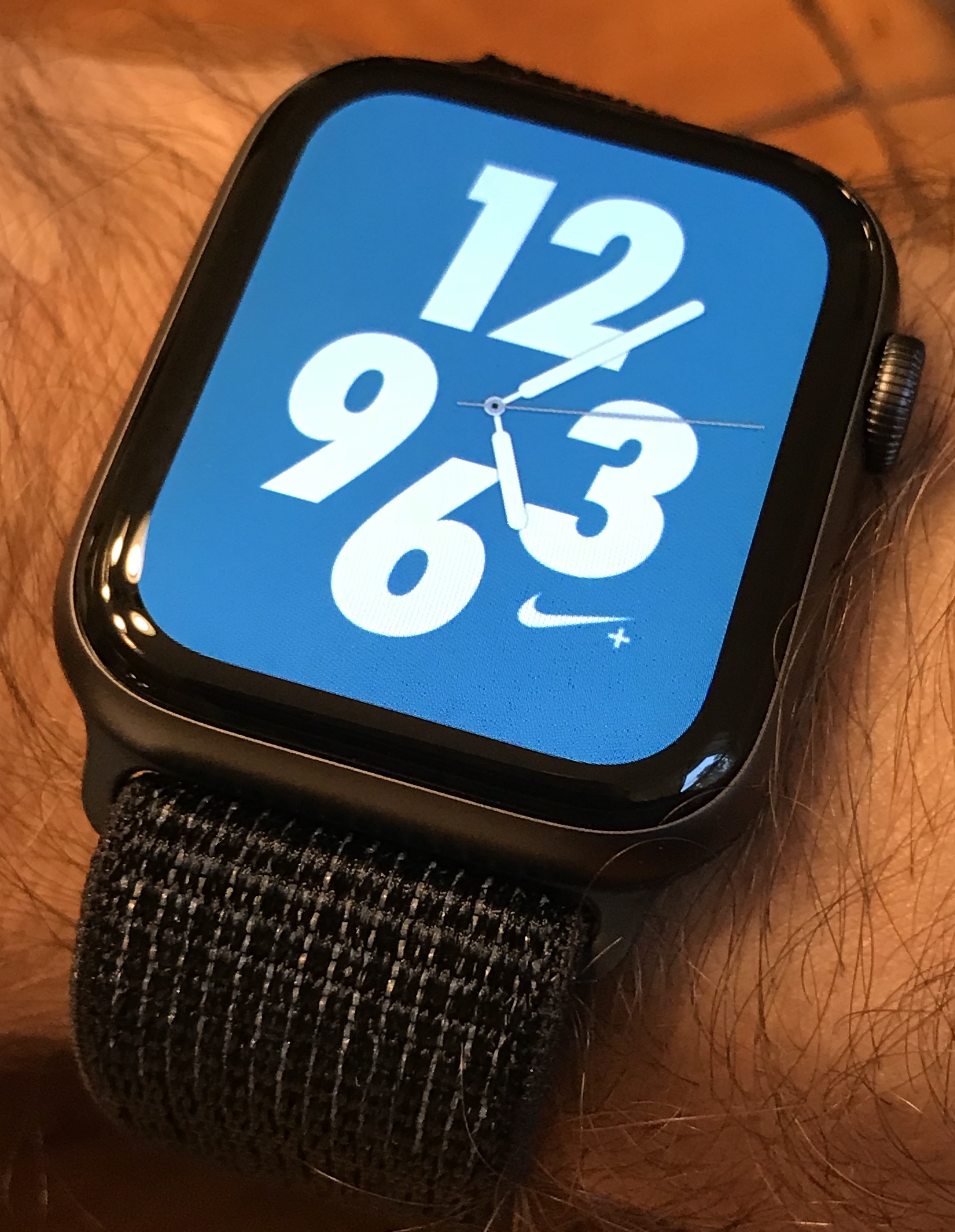 Show off your Apple Watch | MacRumors Forums