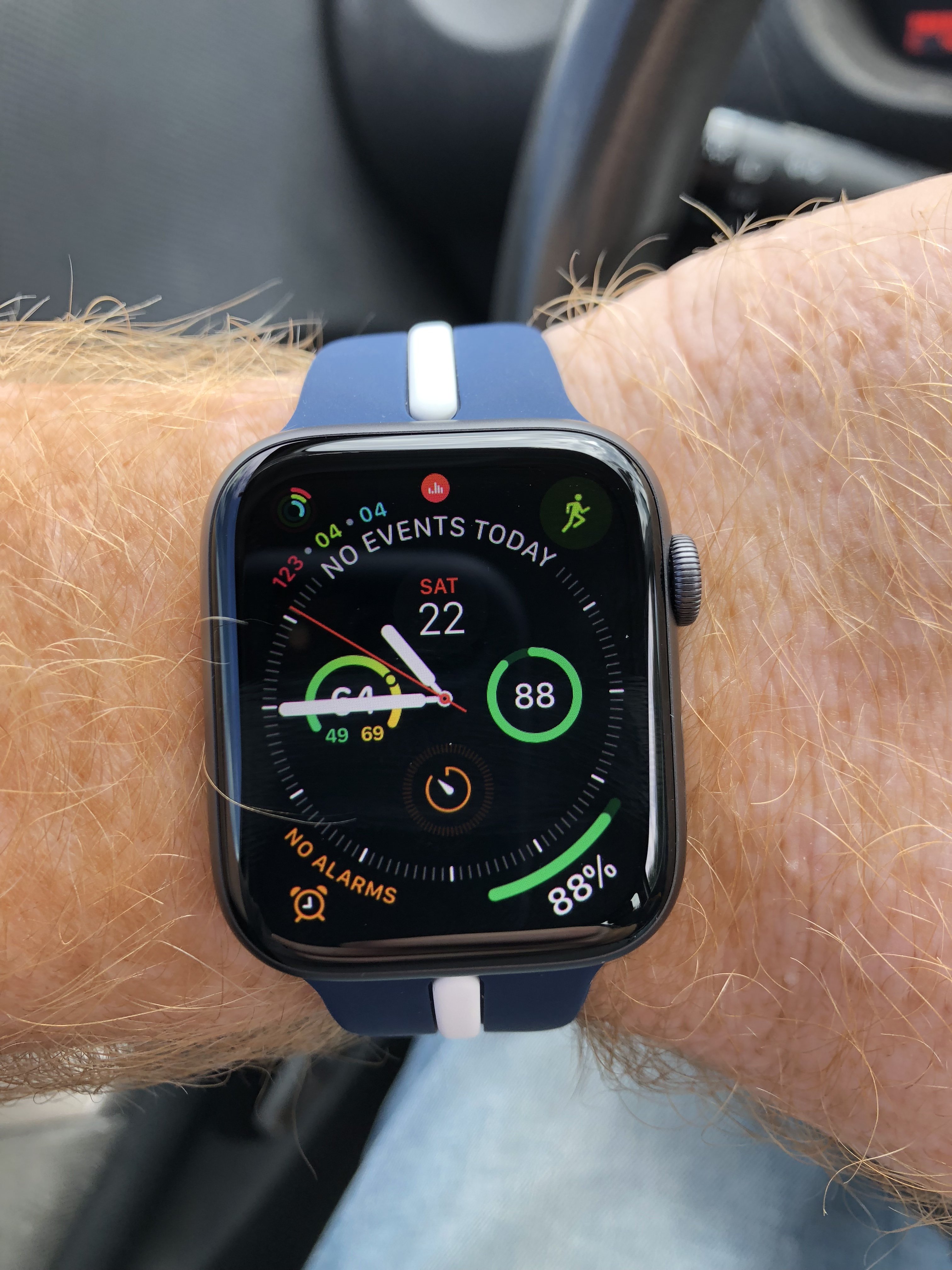 Show off your Apple Watch | Page 359 | MacRumors Forums