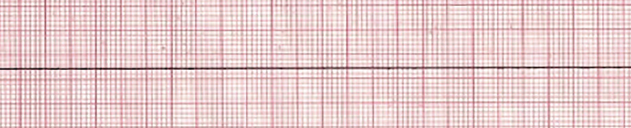 acls-rhythm-pulseless-asystole.jpg