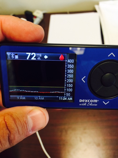 Dexcom CGM.jpg