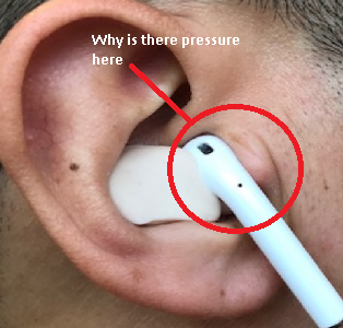 Ear.png