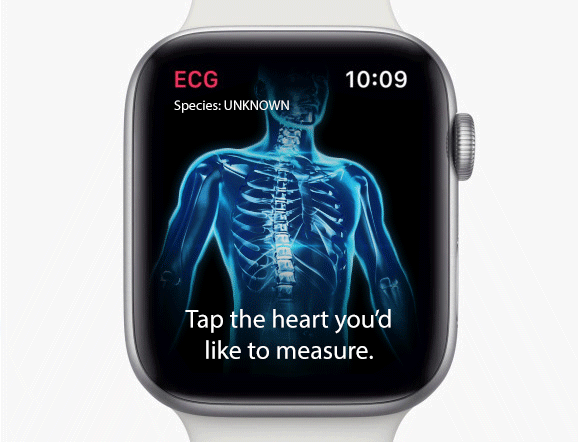 ECG can't find heart process.gif