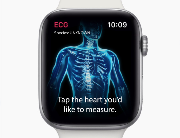 ECG.jpg