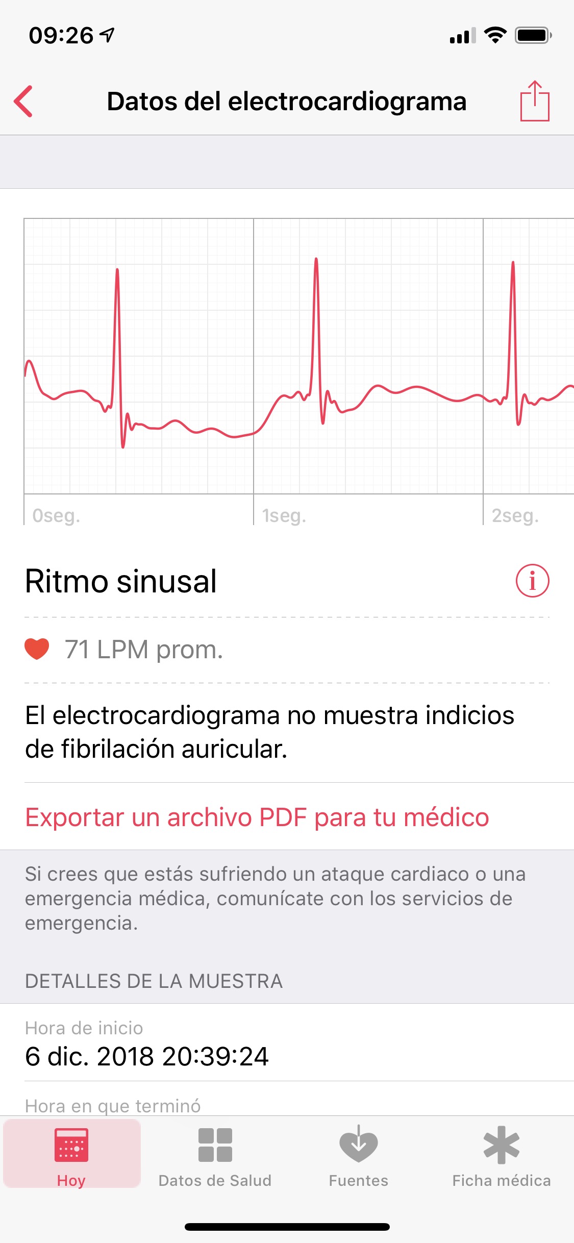 ecg app release date