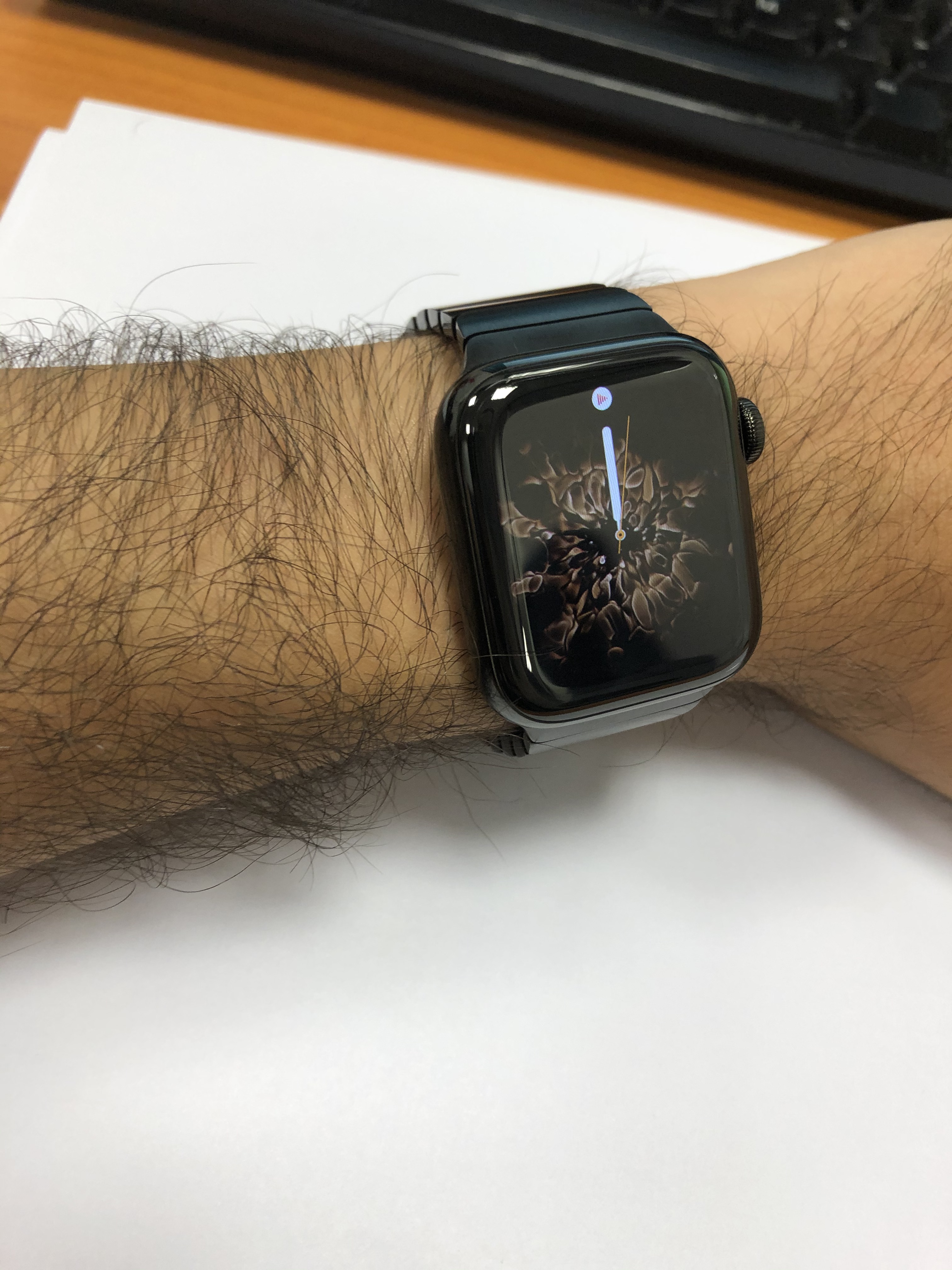 apple watch burning wrist