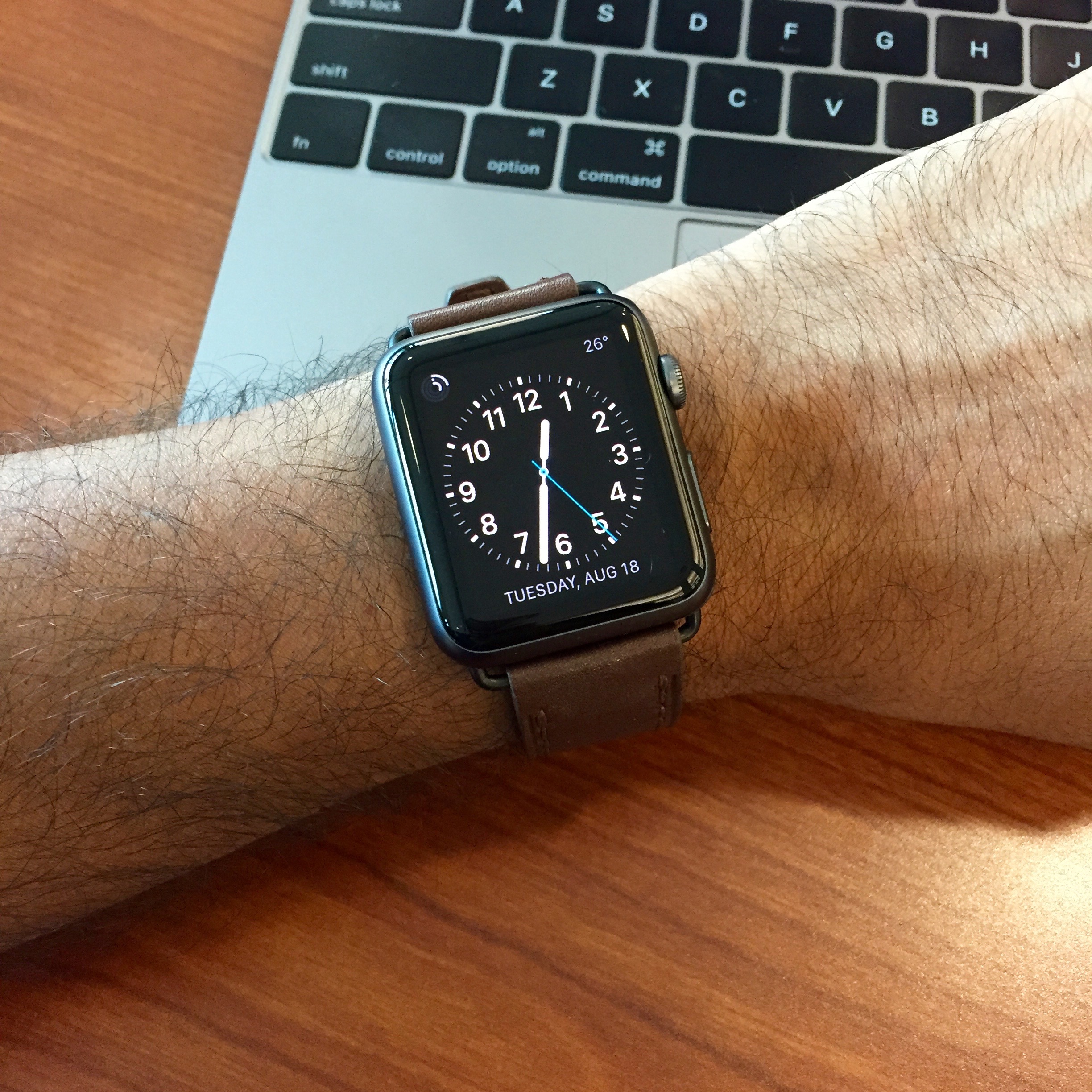 fossil watch compared to apple watch