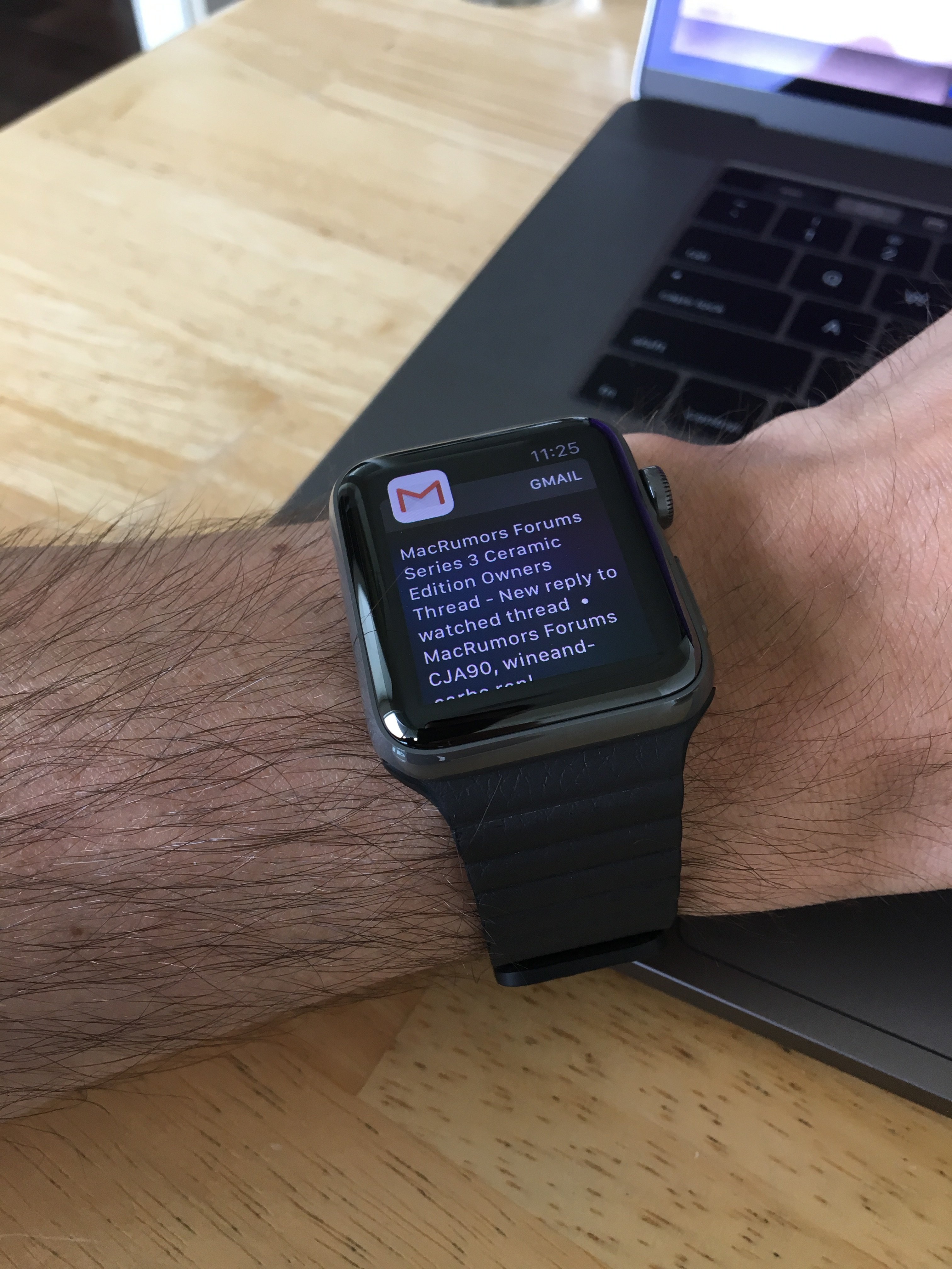 ecg on watch