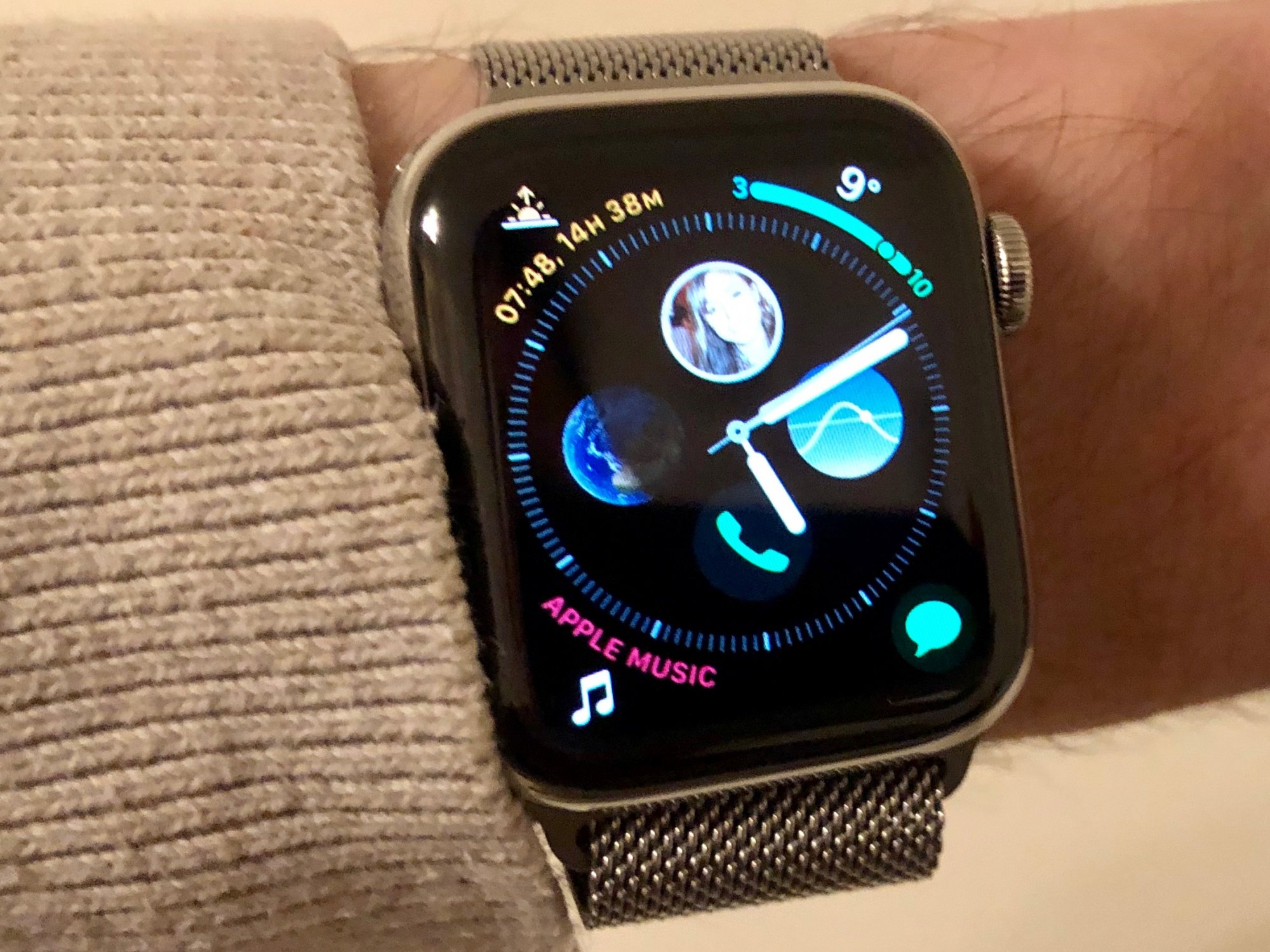 apple watch burning wrist