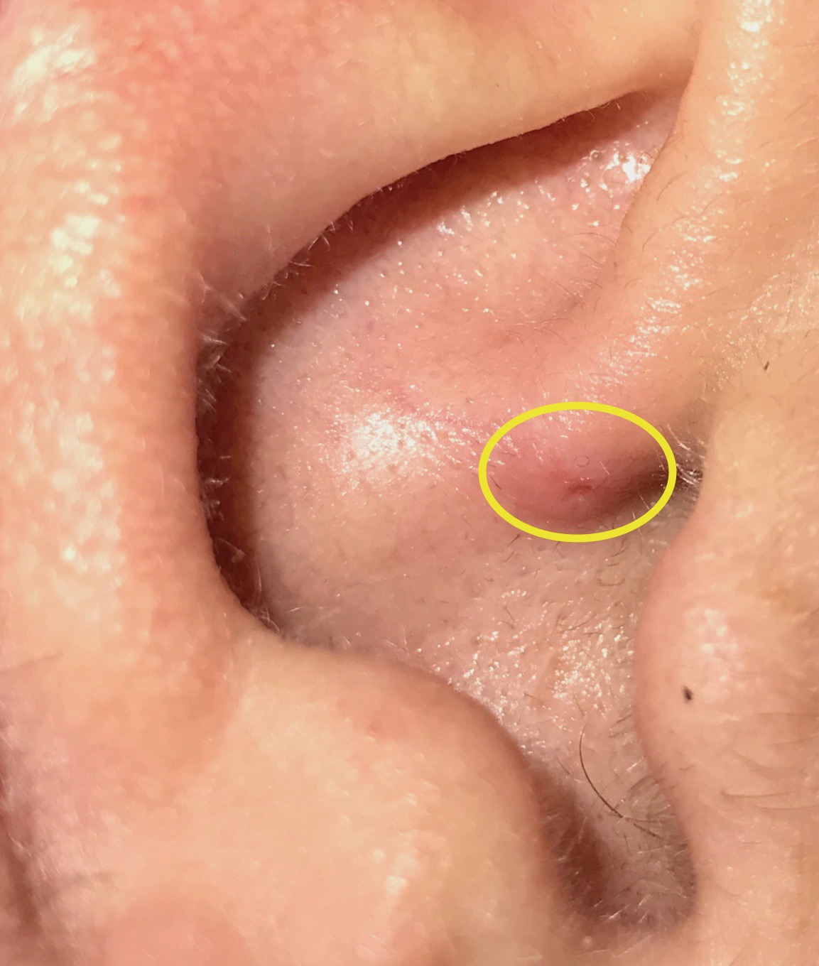 My ears hurt after wearing airpods sale