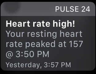 High heart rate alert hotsell
