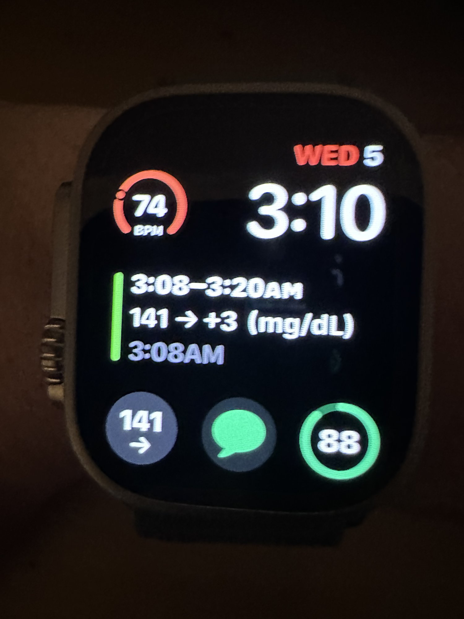 Dexcom G6 App And Complication Working On Apple Watch Ultra MacRumors 