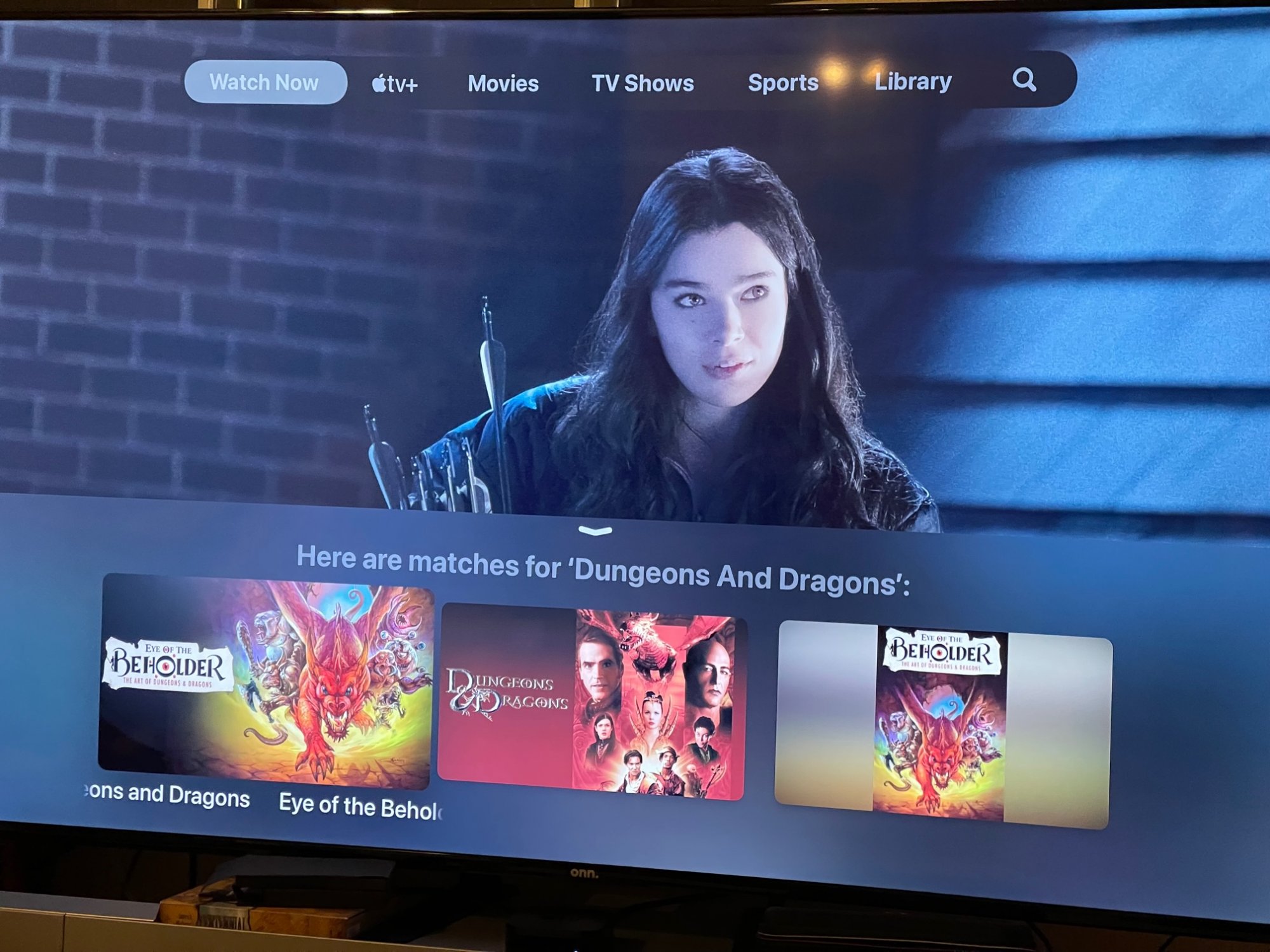 What's the Difference Between Apple TV and Fire Stick?