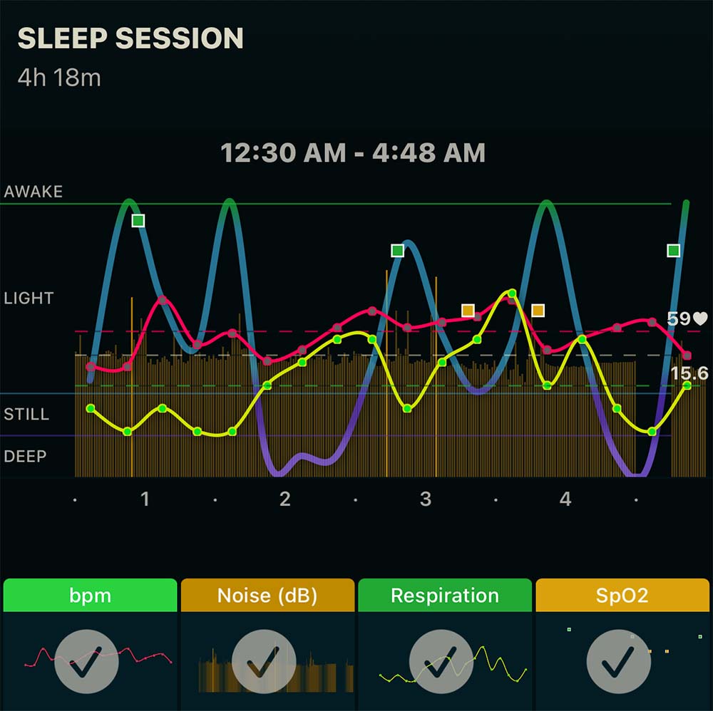 sleepsession.jpg