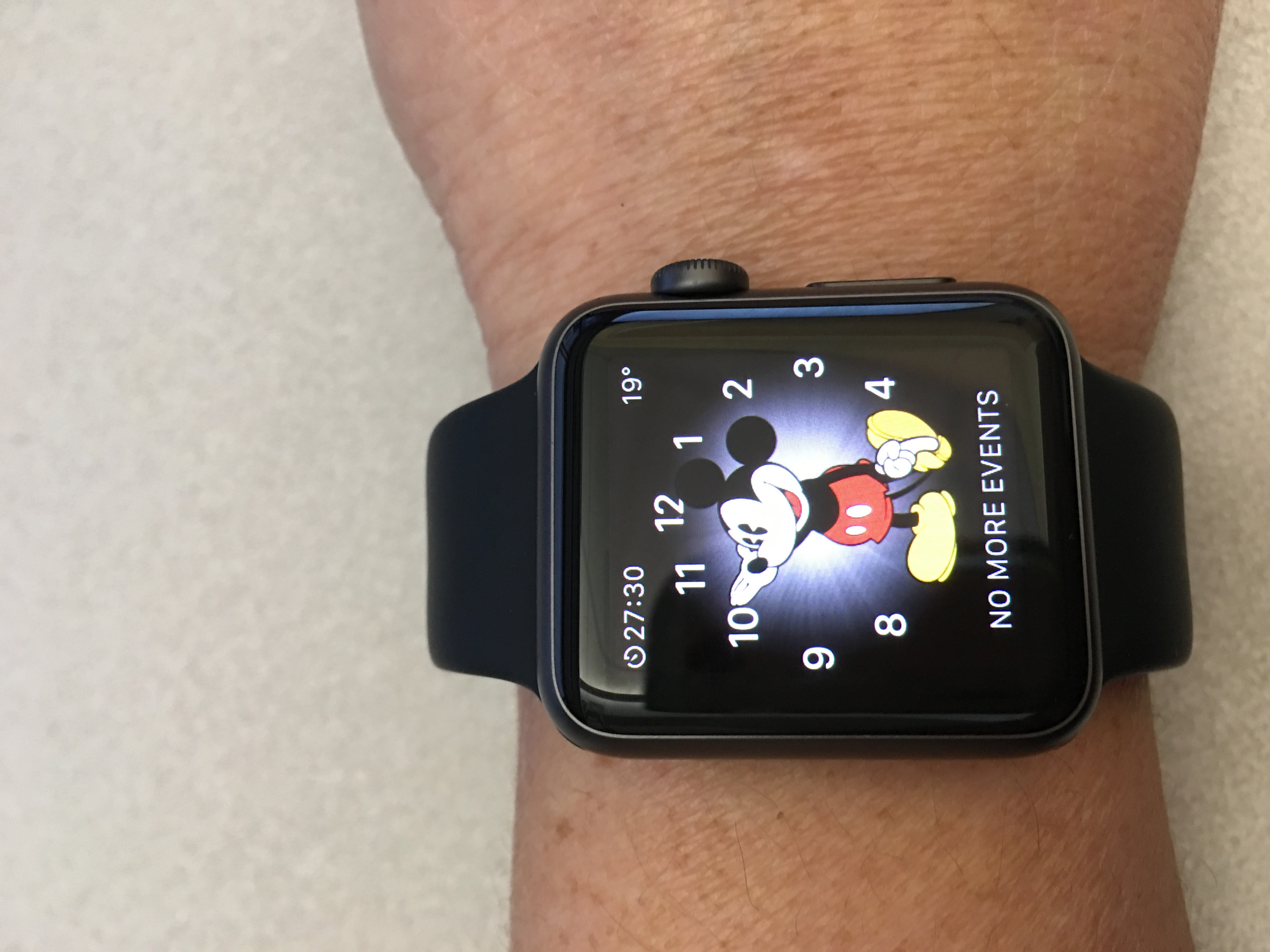 Apple Watch on Very Skinny Wrist. | MacRumors Forums
