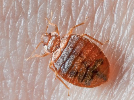 bed-bug-on-skin.jpg