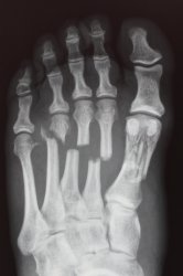 7-5-10.JPG