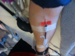 Needle.JPG