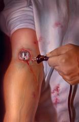 arm_plug.jpg