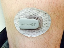 dexcom.jpg