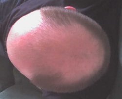bald-spot?.jpg