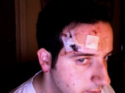 stitches.jpg