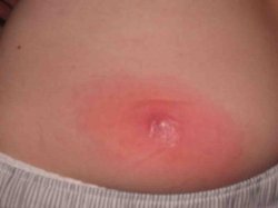 butttwo.jpg butttwo.jpg
