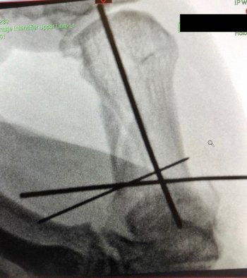 380ba1da-8cad-41d0-9dbe-f76b3ace02cc 2.jpg