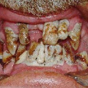 rotteeth.jpg
