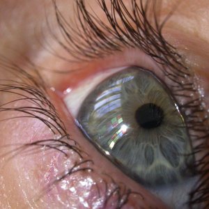 eye3.jpg