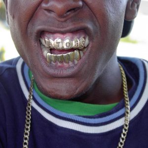 teeth.jpg