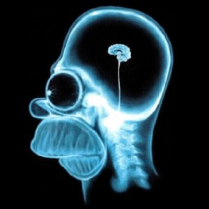 homer-small-brain-xray.jpg