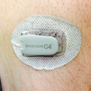 dexcom.jpg