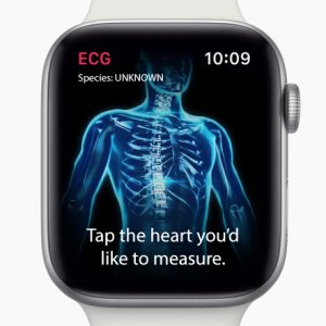 ECG.jpg