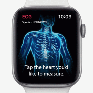 ECG can't find heart process.gif