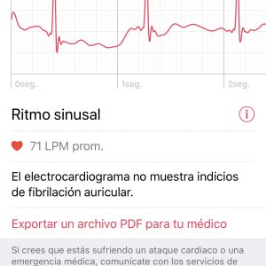 EKG.jpg