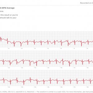 ECG12-9.jpg