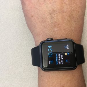 wrist3.jpg