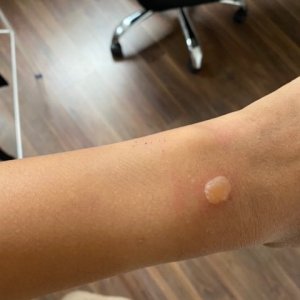 thumbnail_Overnight Burn 19Nov21.jpg