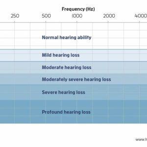 degrees-of-hearing-loss-audiogram-hh19(1).jpeg