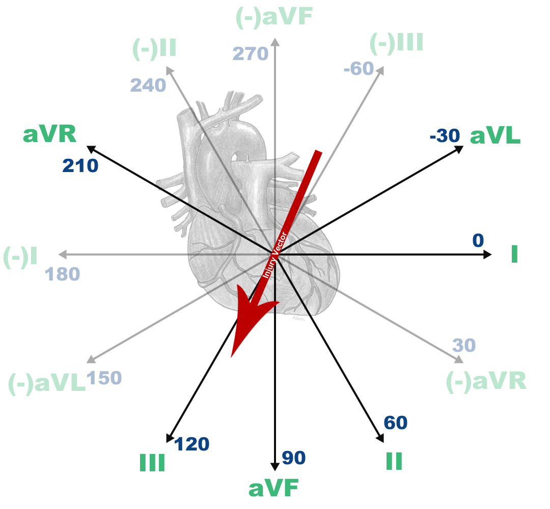 04-Negatives-+-Heart-+-Vector.png