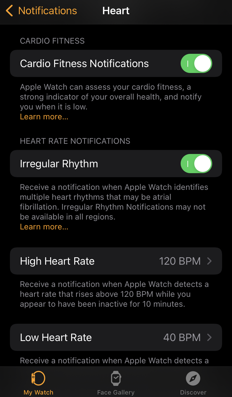 afib.png