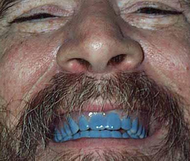 blueteeth5.jpg