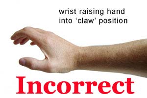 clawed_hands_rsi_sm.jpg