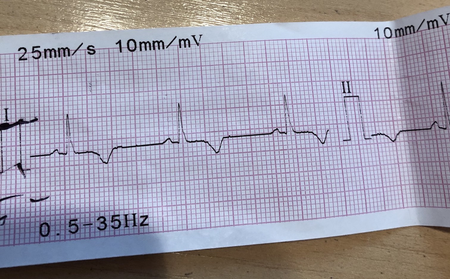 ECG-1.jpg