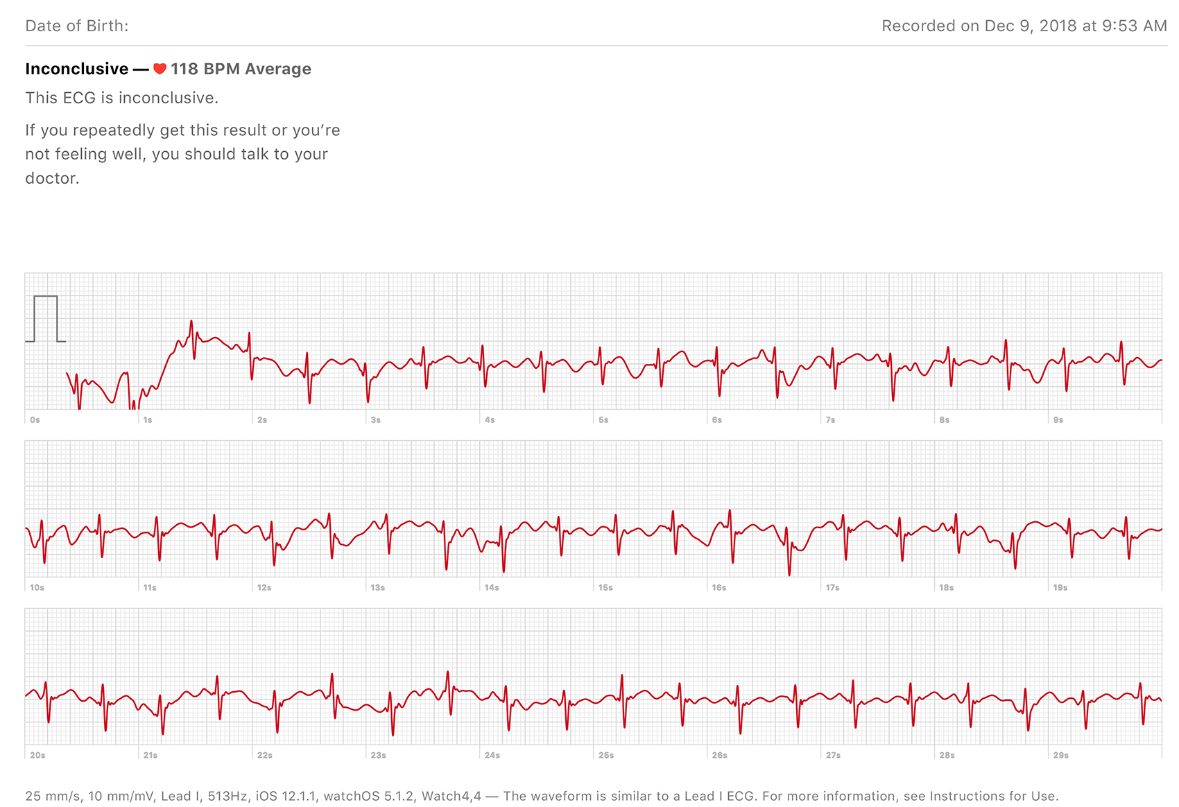 ECG12-9.jpg