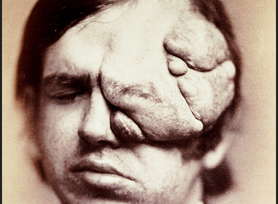 FACE.png