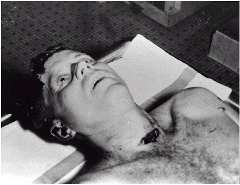 JFKEyes.jpg