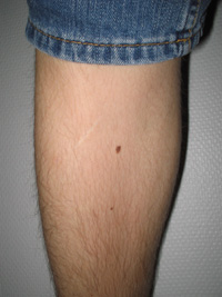 leg.jpg
