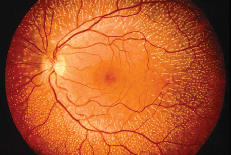 retina1.jpg