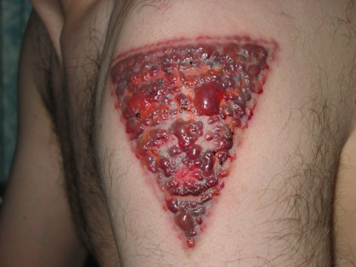 tatty.jpg